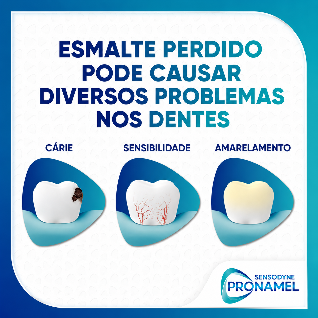 A perda do esmalte leva a cáries, sensibilidade e amarelamento
